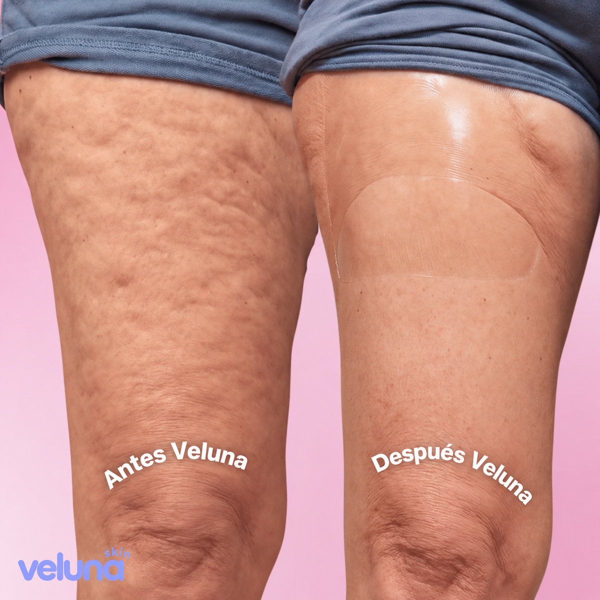 Veluna Lift™ – Cintas Elevadoras para Piernas y Glúteos